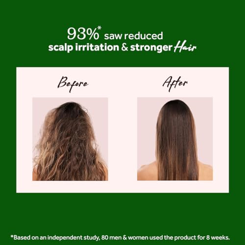 Atulya Neem & Sage Hair Mask for Controlling Dandruff & White Flakes | Anti-Dandruff | Reduces Hair Fall | Paraben, Sulphate & Silicone Free | All Hair Types | 200gm - Image 5