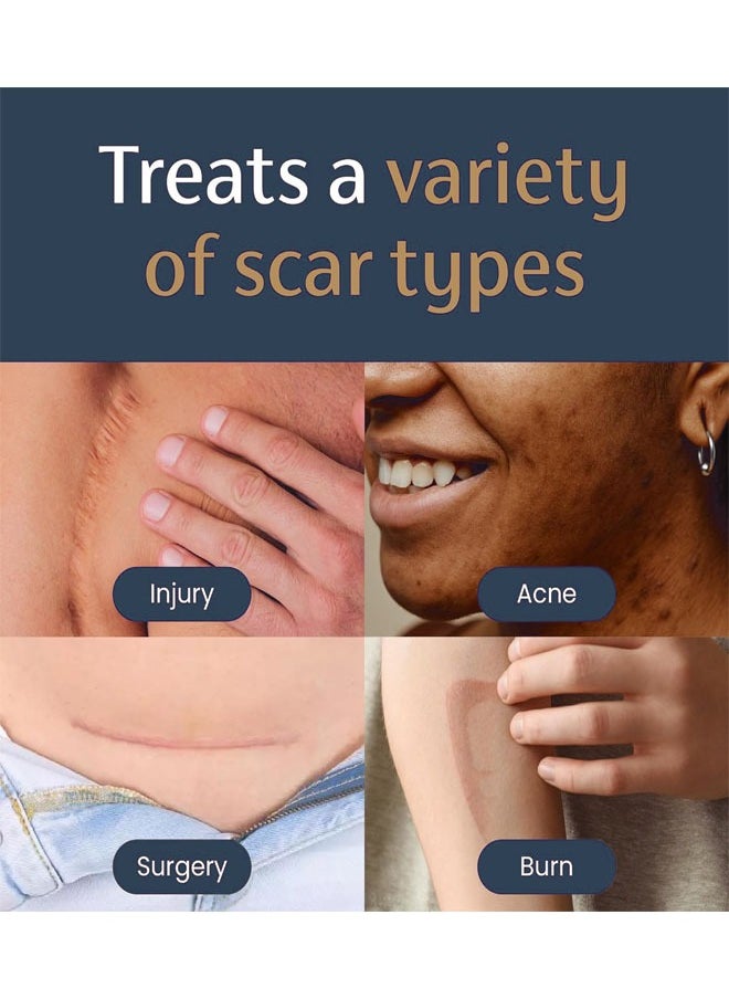 Dermatix Advanced Scar Gel 15g For Cosmetic Improvement of Scars, Fast Drying and Unique Silicone Gel Formulation, Used For Treatment of Keloids, Surgical and Hypertrophic Scars, Suitable For Sensitive Skin  - Image 4
