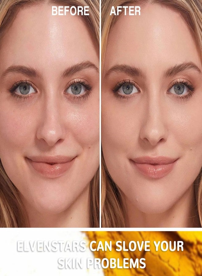 نيليس قناع جيلي نيليس الاحترافي للوجه، قناع جيلي للمنطقة الحساسة | لترطيب فوري، قناع نباتي مقشر للوجه، لترطيب البشرة (مضاد لليوريا) - Image 3