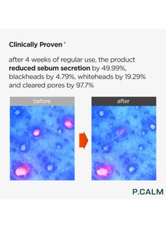 P.CALM PCALM UnderPore Foam Cleanser 150ml  - Image 3