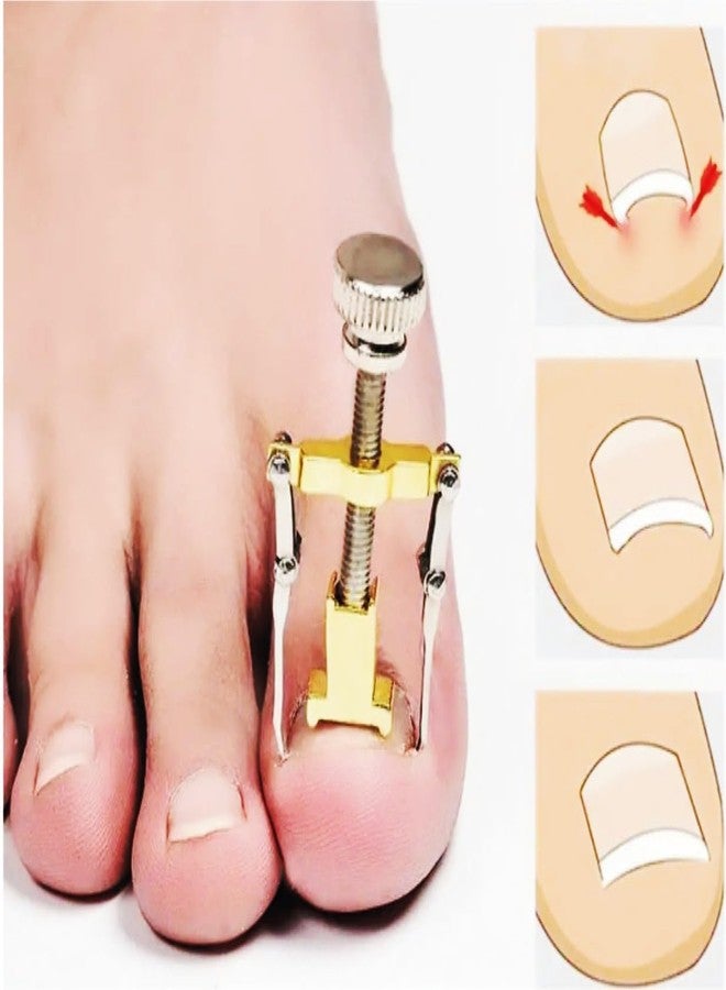 Jeoga Professional Ingrown Toenail Correction Tool and Cuticle Remover Combo Pack - Stainless Steel Toe Nail Corrector for Pain Relief & Paronychia Treatment - Orthopedic Home Pedicure Kit for Thick & Curved Nails - Image 3