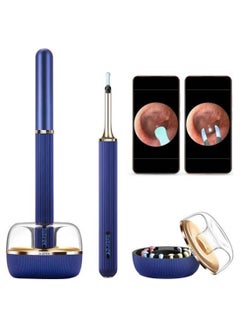 Bebird Robotic Arm Visual Earwax Removal Note 5 Pro - Starry Blue  - Image 1