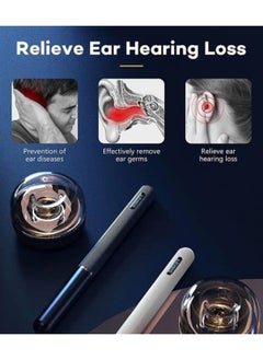 Bebird Robotic Arm Visual Earwax Removal Note 5 Pro - Starry Blue  - Image 4