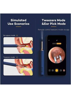 Bebird Robotic Arm Visual Earwax Removal Note 5 Pro - Starry Blue  - Image 3