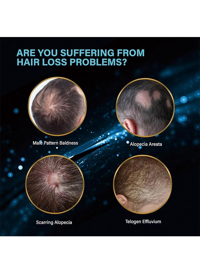 YURHERSU 5% Minoxidil Hair Growth Serum , Restore Thinning Hair Reduce Hair Loss, Stimulate New Hair Nursing Scalp for Women Men Get Stronger Thicker Longer Hair or Beard 30ml - Image 2