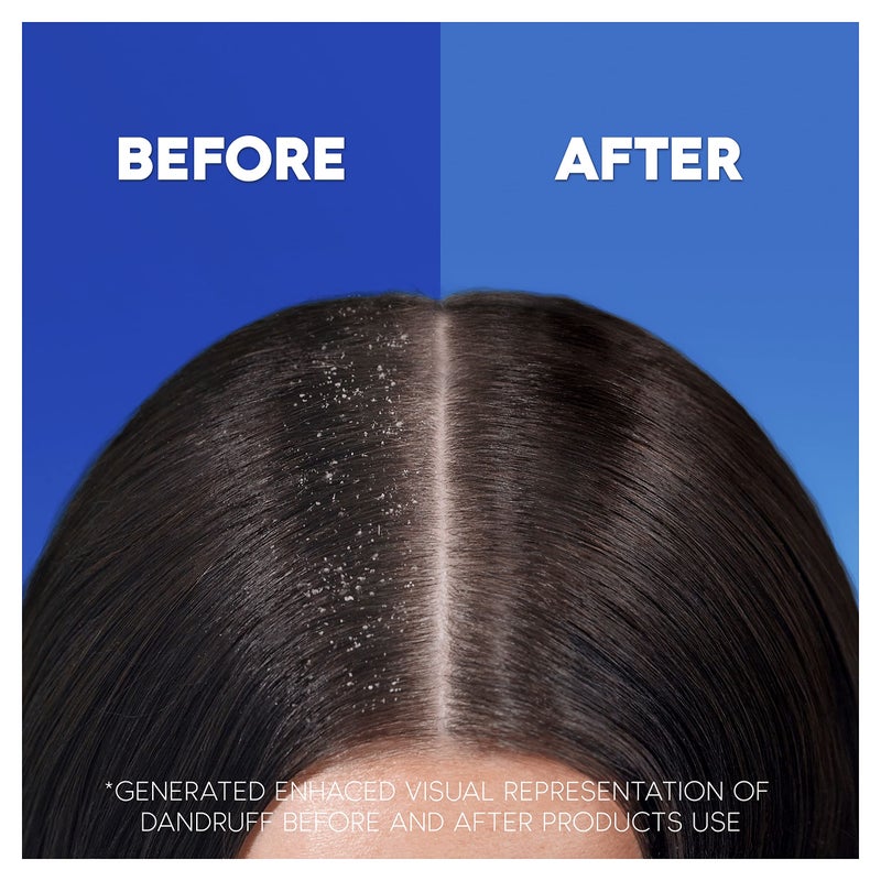 Head & Shoulders Anti-Dandruff Classic Clean Shampoo x 250ml - Image 2