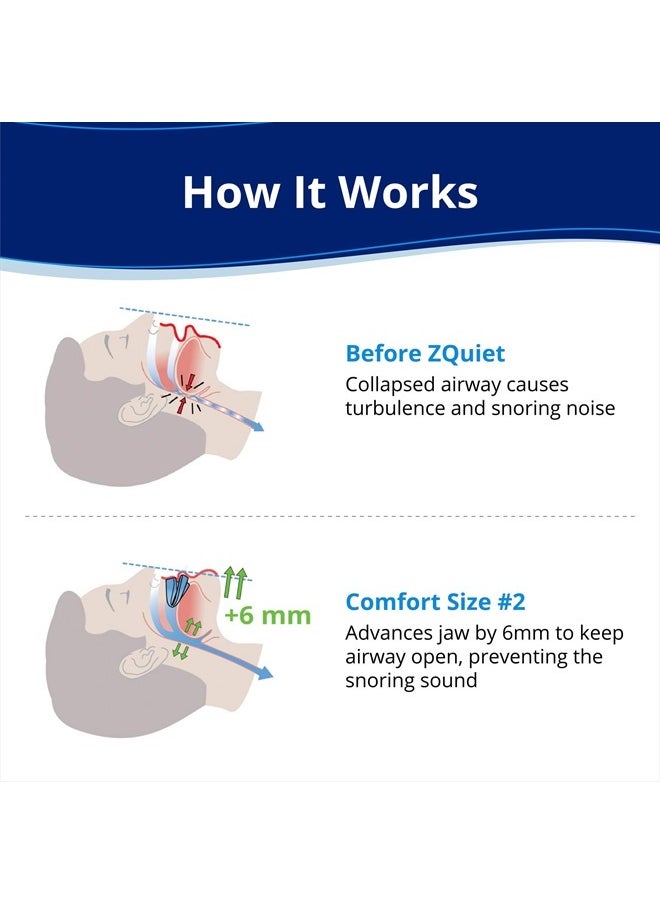 ZQuiet - Anti-Snoring Mouthpiece, Size #2 Single Pack - Image 1