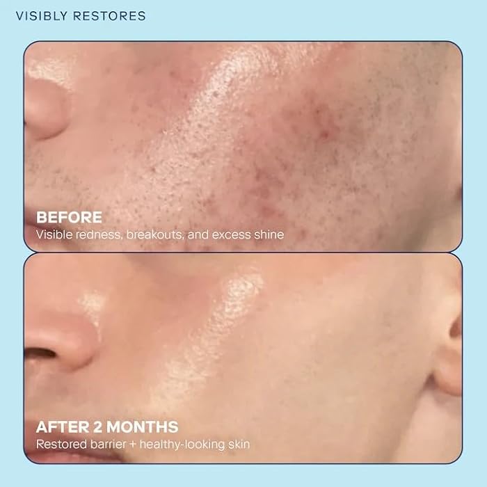 Skinfix Barrier+ Skin Barrier Restoring Gel Cream Mini - 0.5 oz - Hydrating Face Cream for Dry Skin - Strengthens, Visibly Plumps & Firms - Non-Comedogenic - Fragrance Free - Vegan, Cruelty Free - Image 2