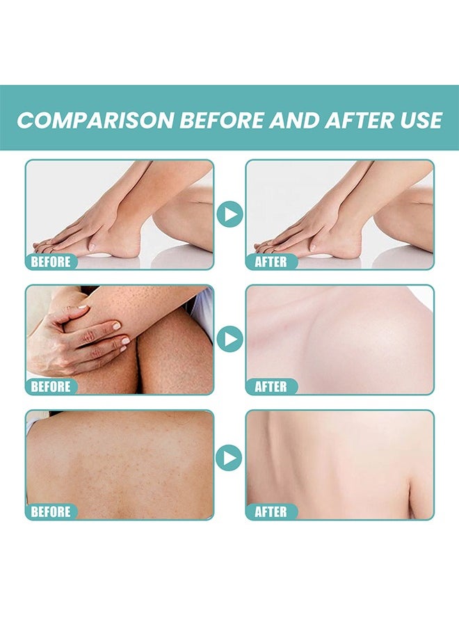 EELHOE Skin Bath Oil，Skin Bath Oil So Soft Sensual, Original Skin Bath Oil So Soft, Skin Moisturizing Smoothes & Softens Skin Soft, Original Bath Oil for Women Men 100ml  - Image 4