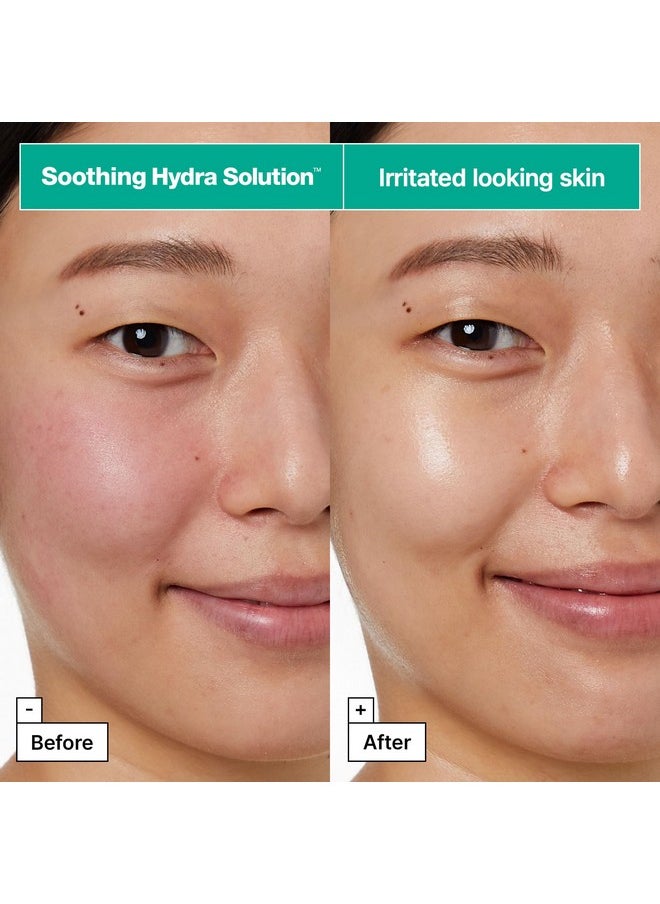 Dr.Jart+ - Dr.Jart+ Dermask™ Soothing Hydra Solution™ Face Mask for Visibly Irritated Skin | Sheet Mask | Korean Skin Care, 5 Pack - Image 1