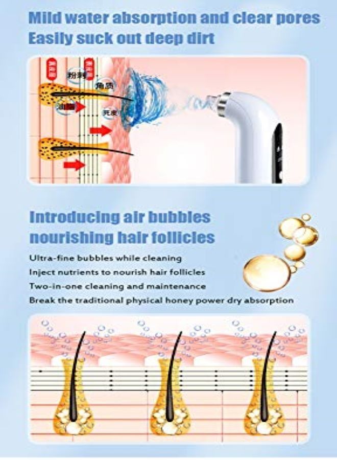 Generic Super micro bubble beauty instrument,Blackhead Remover With 6 Suction Heads Replaceable,Strong Suction Comedone Extractor Tool for Acne Removal Blackhead Sucker  - Image 5