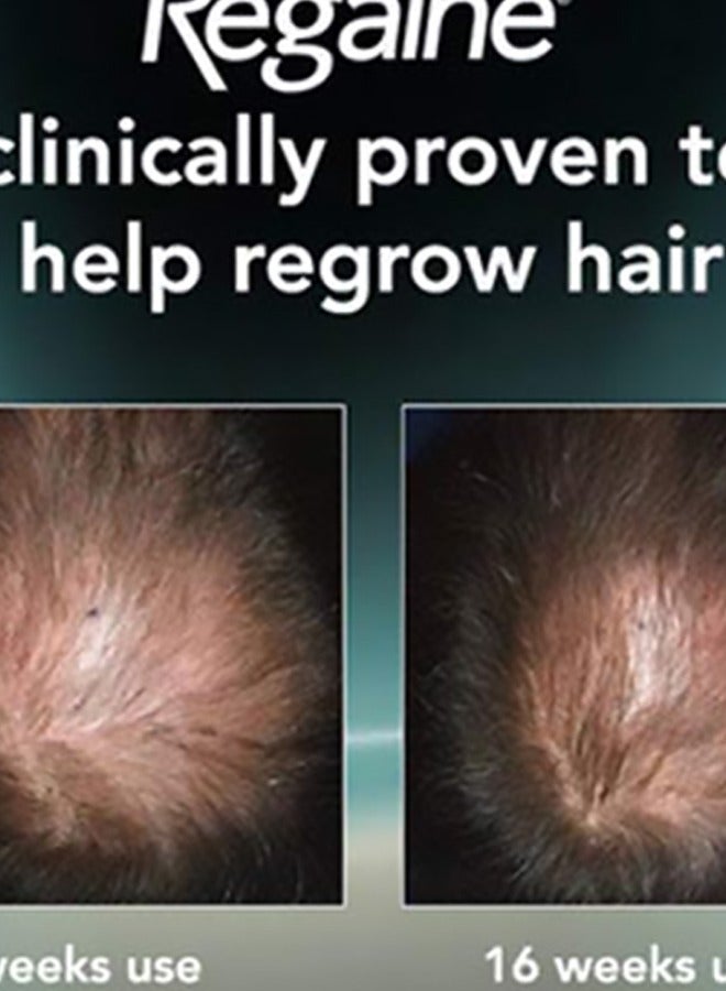 ريجين مجموعة إسفنجية لإعادة نمو فروة الرأس مكونة من 3 قطع - Image 2