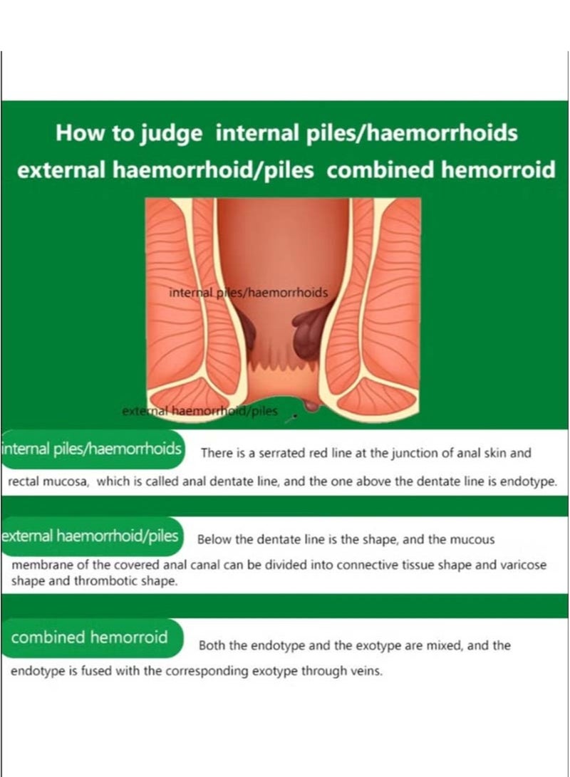 DERMFREE Hemorrhoid Ointment 42.5g Hemorrhoid Treatment Hemorrhoid Cream for Hemorrhoid Discomfort, Cooling Formula with Soothing Ingredients Targets Pain Swelling and Itching Fast Acting Ointment  - Image 5