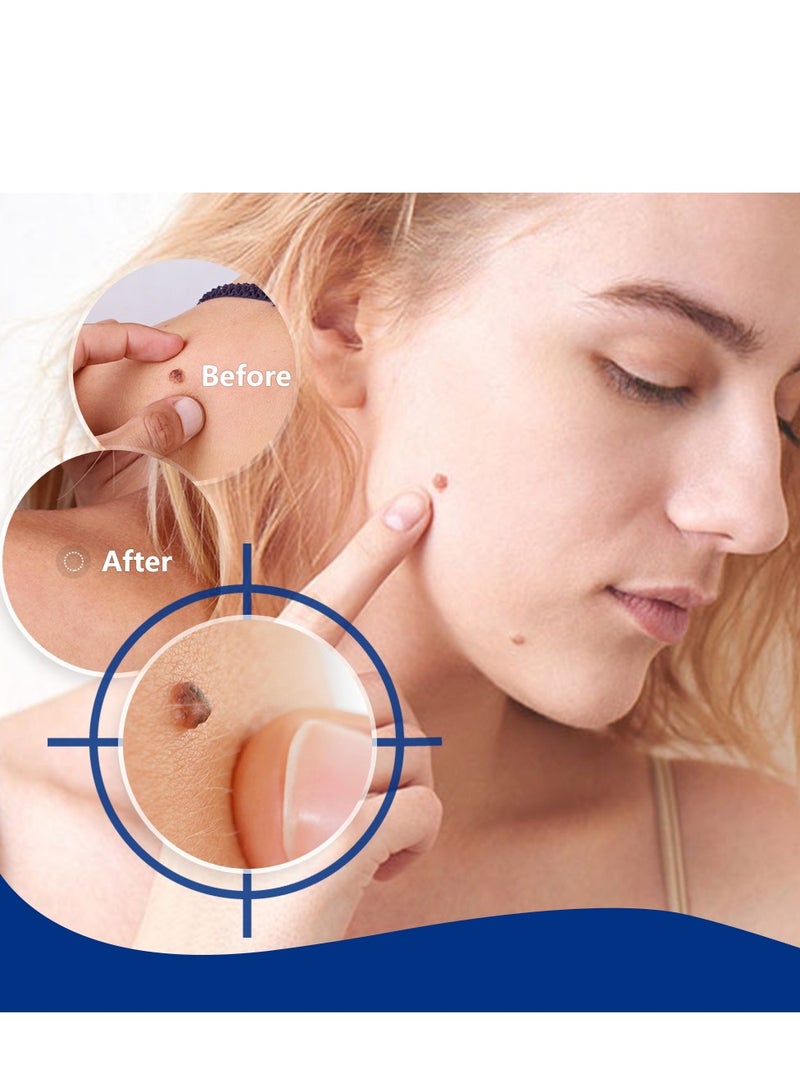 Sumifun Wart Remover, Maximum Strength Salicylic Acid Wart Liquid, One Step Invisible Wart Remover Strips, Fast-Acting Wart Liquid Freeze Off for Warts, Plantar Wart, Common Wart, Flat Wart 20ml - Image 4