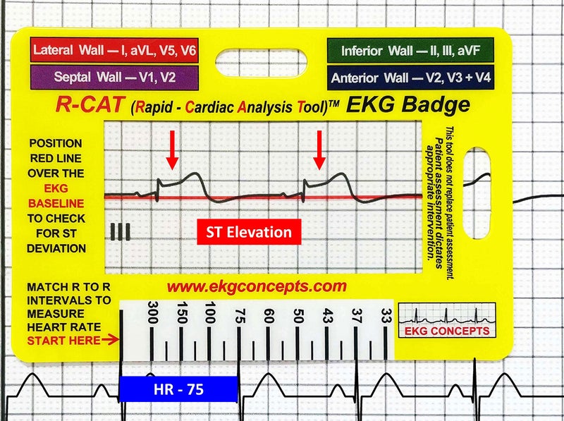 R-Cat شعار R-CAT EKG - Image 2