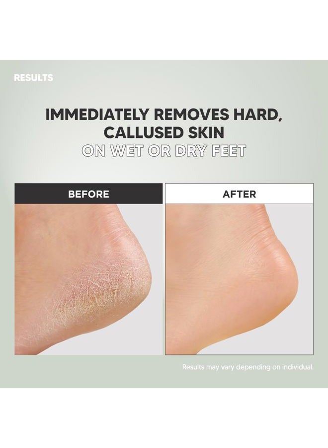 F3 Systems S-Line Emery Foot file, Colossal Double-Sided Pedicure Tool, Effective for ed Heel, Ergonomic Design for Easy Grip - Image 5