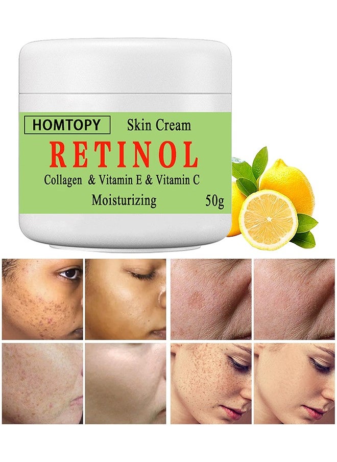 HOMTOPY Retinol And Collagen And Vitamin C Moisturizing Skin Cream, Dark Spot Remover For Face For Face Snd Body Hyperpigmentation, Fades Melasma, Freckle, Sun Spots, Evens Skin Tone, Age Spot Remover 50G  - Image 1