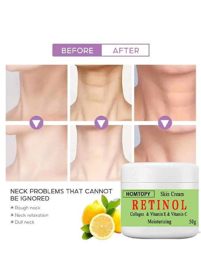 HOMTOPY Retinol And Collagen And Vitamin C Moisturizing Skin Cream, Dark Spot Remover For Face For Face Snd Body Hyperpigmentation, Fades Melasma, Freckle, Sun Spots, Evens Skin Tone, Age Spot Remover 50G  - Image 3