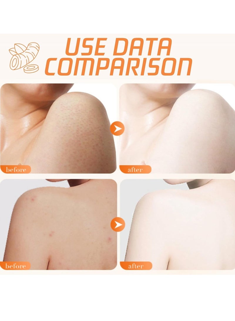 سكين مقشر الجسم بالكركم - مقشر غني بفيتامين سي للتنظيف العميق وإزالة الجلد الميت وتلاشي البقع الداكنة - مقشر الوجه والجسم للنساء والرجال ، 250 جم - Image 3