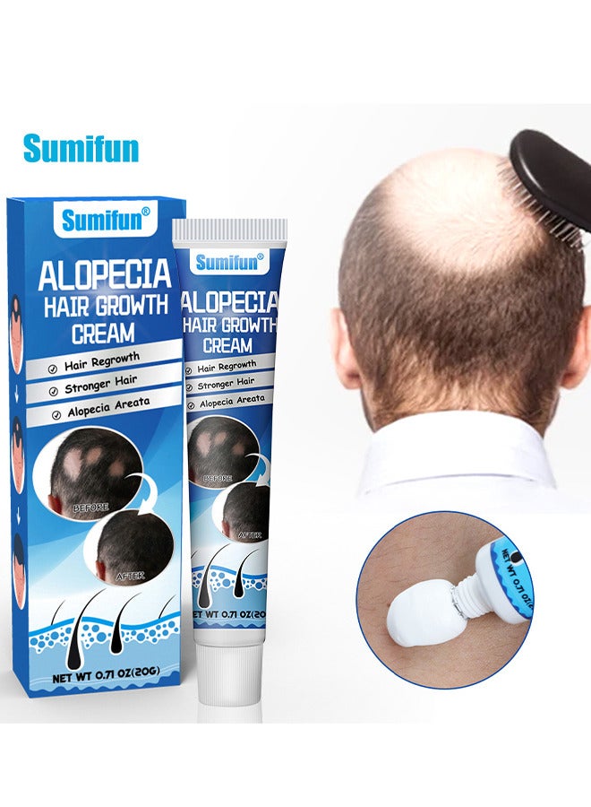 سوميفون كريم نمو الشعر بالثعلبة 20 جرام لتعزيز نمو شعر الرجال ومنع تساقط الشعر والعناية بالشعر - Image 1