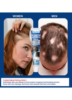 Sumifun 20G Alopecia Hair Growth Cream For Promote Men's Hair Growth, Prevent Hair Loss, Care For Hair  - Image 3