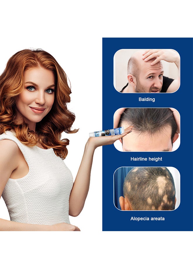 سوميفون كريم نمو الشعر بالثعلبة 20 جرام لتعزيز نمو شعر الرجال ومنع تساقط الشعر والعناية بالشعر - Image 4