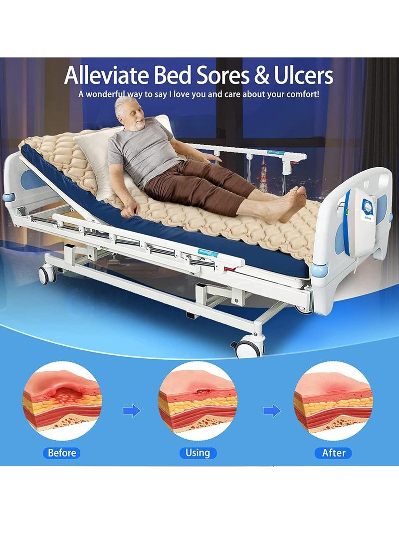 Generic Silent Alternating Air Pressure Mattress With Mattress Cover And Pump Inflatable Adjustable Silent Mattress To Prevent Bedsores And Soreness And Treat Bedridden Patients  - Image 3