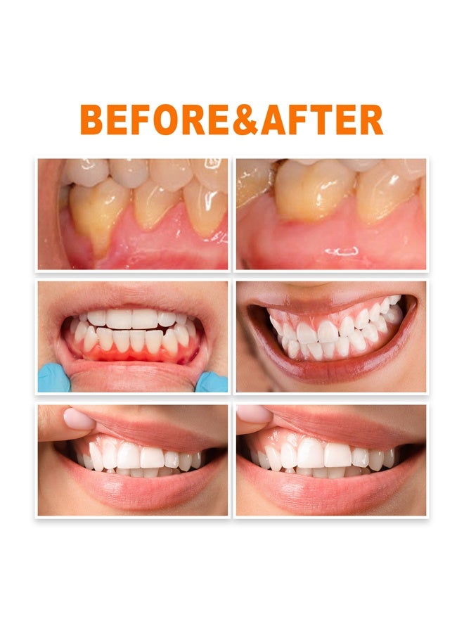 EELHOE Gum Repair Essence Ampoules, Ampoule Tooth Serum, Deep Cleaning And Gum Repair Toothpaste, Fresh Breath, Natural Ingredients, 1.5ml * 7Pcs - Image 5