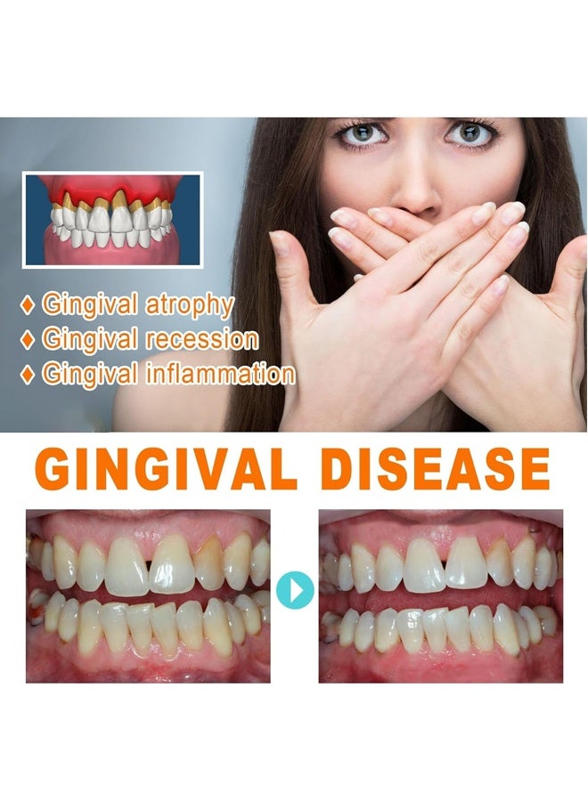 EELHOE Gum Repair Essence Ampoules, Ampoule Tooth Serum, Deep Cleaning And Gum Repair Toothpaste, Fresh Breath, Natural Ingredients, 1.5ml * 7Pcs - Image 3