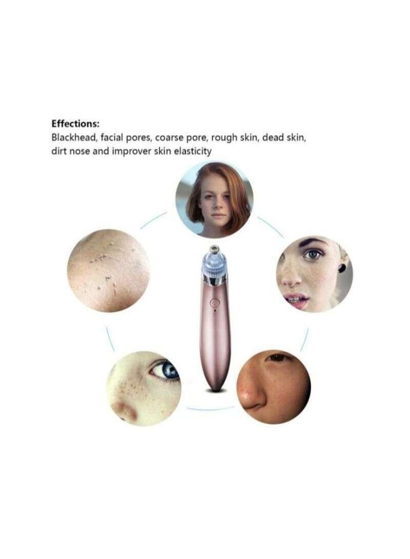 shAyzee Electric Blackhead Vacuum Remover Gold/Silver/Clear - Image 5
