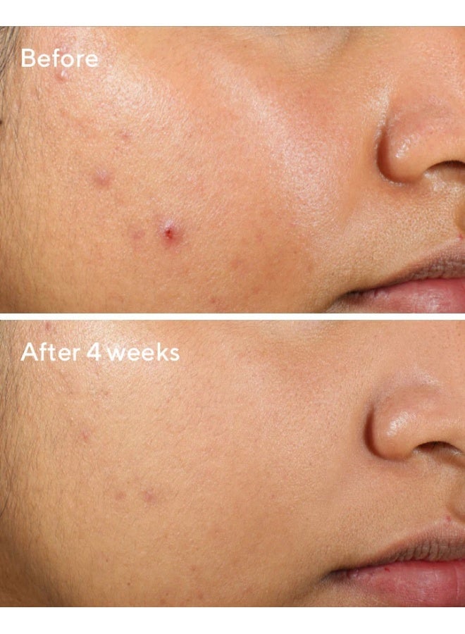 Murad جل مرطب خالي من الزيت - يرطب البشرة المعرضة للبثور، يهدئ الاحمرار ويقلل من دهنية البشرة للحصول على بشرة متوازنة (60 مل) - Image 3