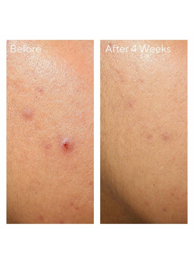 Murad جل مرطب خالي من الزيت - يرطب البشرة المعرضة للبثور، يهدئ الاحمرار ويقلل من دهنية البشرة للحصول على بشرة متوازنة (60 مل) - Image 4