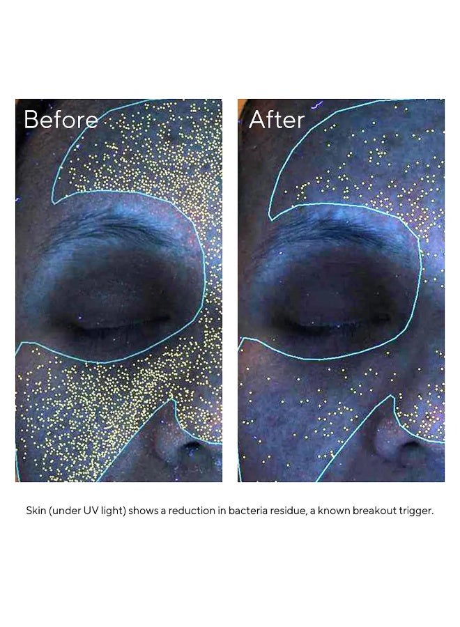 Murad جل مرطب خالي من الزيت - يرطب البشرة المعرضة للبثور، يهدئ الاحمرار ويقلل من دهنية البشرة للحصول على بشرة متوازنة (60 مل) - Image 5