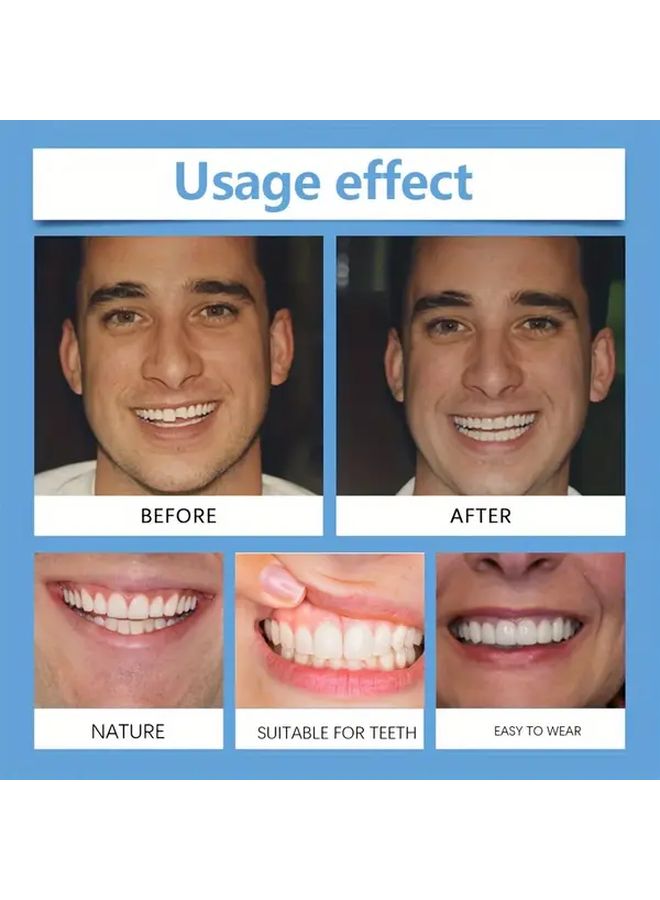 8pcs White Adjustable Braces Set Including 4 Upper and 4 Lower Teeth Invisible Denture Aligners Comfortable Orthodontic DIY Dental Aligners Kit No Scent Fits Most Mouths With Storage Box - Image 5