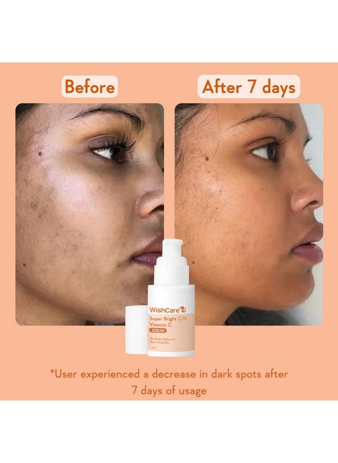 WishCare - Super Bright C16 Vitamin C Face Serum - 10% Vitamin C, 4% Niacinamide, 1% Kojic Acid, 0.5% Ferulic Acid, Licorice & 4-N-Br - For Pigmentation & Dark Spots 30Ml - Image 1