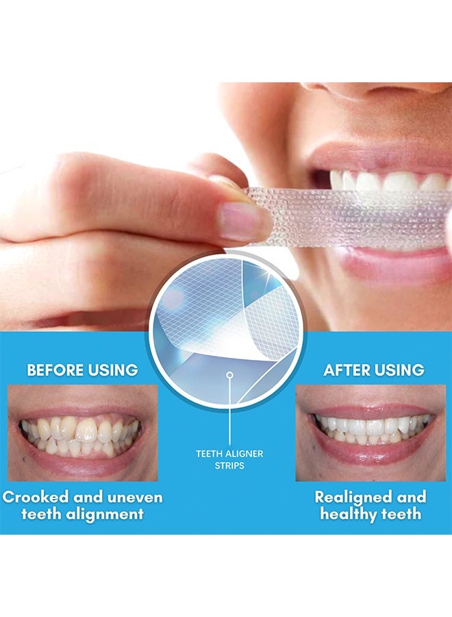 ORALHOE Teeth Aligner Strips, Teeth Whitening Strips, For Reduce Teeth Sensitive, Teeth Whitener Clean Teeth Safely, Effectively Remove Coffee, Tobacco Stains, Professional And Safe White Strips (7 Pieces) - Image 3
