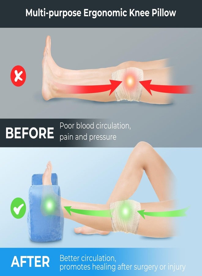 EKEPE Knee Replacement Surgery Pillow for Post Surgery Recovery - ACL Surgery, Knee Surgery and Hip Surgery Recovery, Portable Leg Elevation Pillow for Knee Surgery Recovery, Rehab, Extension - Image 2