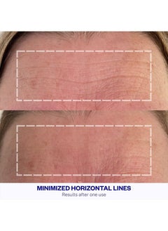 WRINKLES SCHMINKLES Forehead Wrinkle Patches, 1-Pack, Reusable Hypoallergenic Silicone Smoothing Pads for Reducing Frown Lines & Face Lift Overnight  - Image 2