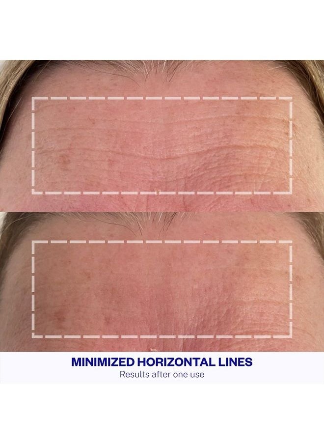 WRINKLES SCHMINKLES - Forehead Wrinkle Patches, 1-Pack, Reusable Hypoallergenic Silicone Smoothing Pads for Reducing Frown Lines & Face Lift Overnight - Image 1
