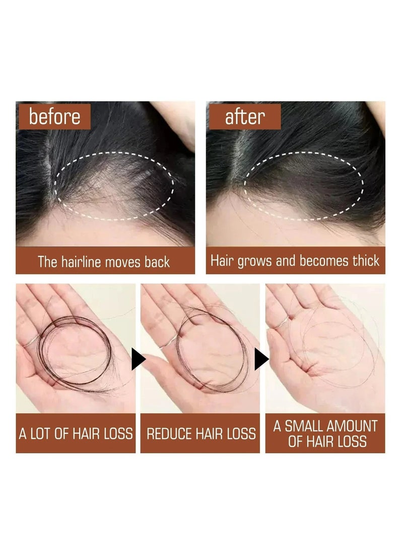 EELHOE Batana Oil for Hair Growth 120ml, 100% Unrefined Batana Hair Oil for Thicker Fuller Hair, Deep Nourishing Hair Treatment for Dry Damaged Hair, Strengthening Moisturizing Scalp & Hair Care - Image 4