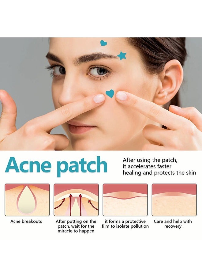 West&Month Pimple Patches for Face, 216 Pcs Hydrocolloid Acne Patches for Covering Zits and Blemishes, Cute Spot Stickers for Skin Care  - Image 3