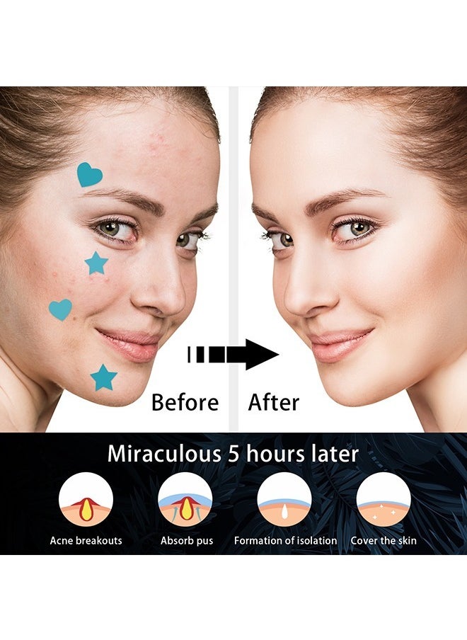 West&Month Pimple Patches for Face, 216 Pcs Hydrocolloid Acne Patches for Covering Zits and Blemishes, Cute Spot Stickers for Skin Care  - Image 4