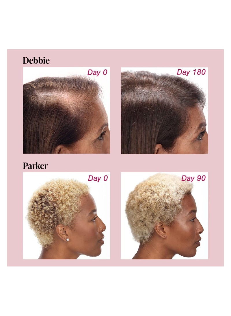 Viviscal Hair Growth Supplements for Women Fuller Hair with Collagen Complex 60 Tablets - Image 5