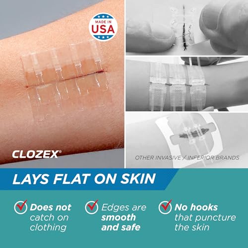 Clozex Pediatric Laceration Closures - Repair Wounds Without Stitches, FSA HSA Eligible Skin Closure Device for 3 Individual Wounds Or Combine for Total Length of 2 3/8 Inches - Image 4