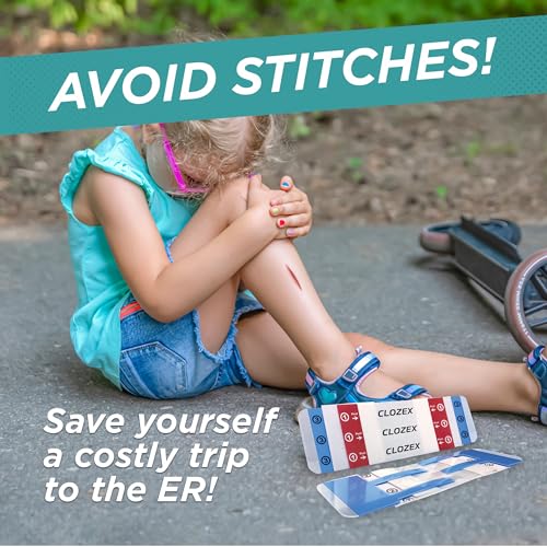 Clozex Pediatric Laceration Closures - Repair Wounds Without Stitches, FSA HSA Eligible Skin Closure Device for 3 Individual Wounds Or Combine for Total Length of 2 3/8 Inches - Image 2