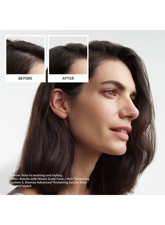 Nioxin System 3 Scalp + Hair Thickening Conditioner | For Colored, Dry, & Damaged Hair with Light Thinning | Maintain Vibrant Color | Strengthen & Nourish with Niacinamide & Biotin | 10.1 Fl Oz - Image 3
