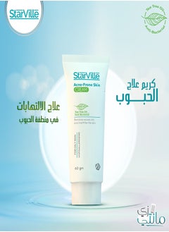 starville Acne Prone Skin Cream 60gm  - Image 4