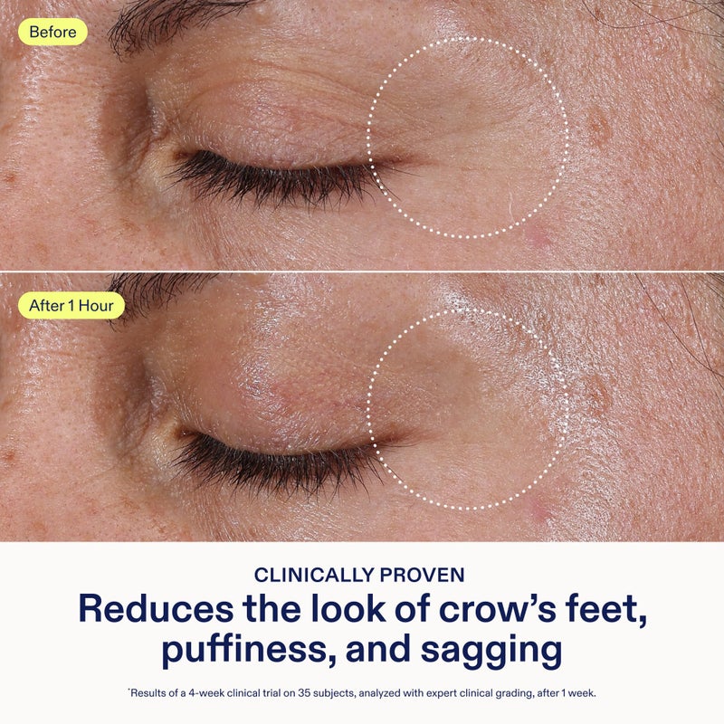 Skinfix علاج العين ثلاثي الدهون من سكين فيكس - 0.5 أونصة سائلة - كريم للعين - يشد visibly، يقلل الانتفاخ ويجعل منطقة تحت العين ناعمة - غير مسبب للرؤوس السوداء - خالي من العطور - نباتي، خالي من القسوة - Image 3