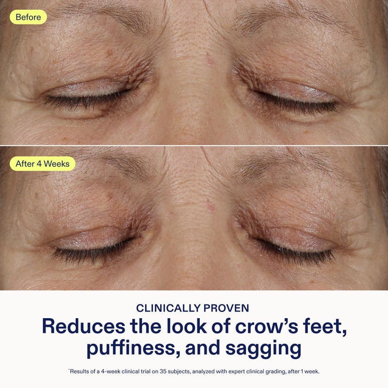 Skinfix علاج العين ثلاثي الدهون من سكين فيكس - 0.5 أونصة سائلة - كريم للعين - يشد visibly، يقلل الانتفاخ ويجعل منطقة تحت العين ناعمة - غير مسبب للرؤوس السوداء - خالي من العطور - نباتي، خالي من القسوة - Image 4