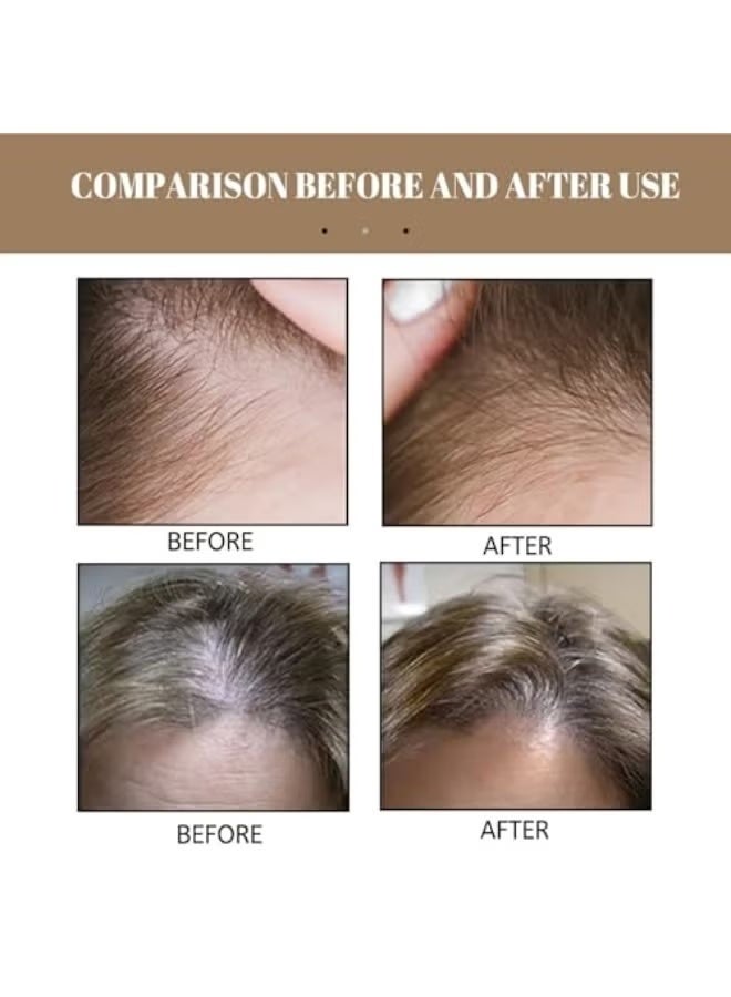 EELHOE 100g Rice Soap Shampoo Bar, Rice Hair Growth Soap, for Soft and Shiny Hair, Strengthens Damaged and Bleached, Reduces Grease - Image 3